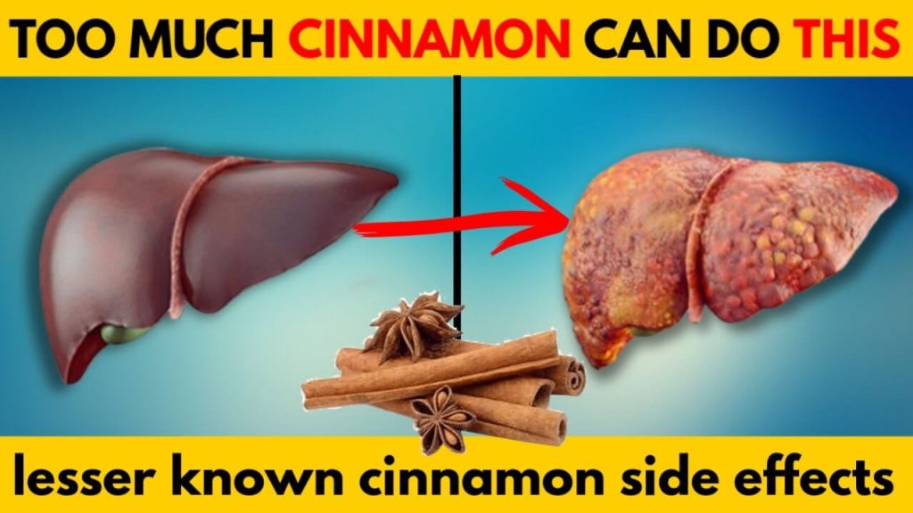 Cinnamon side effect.