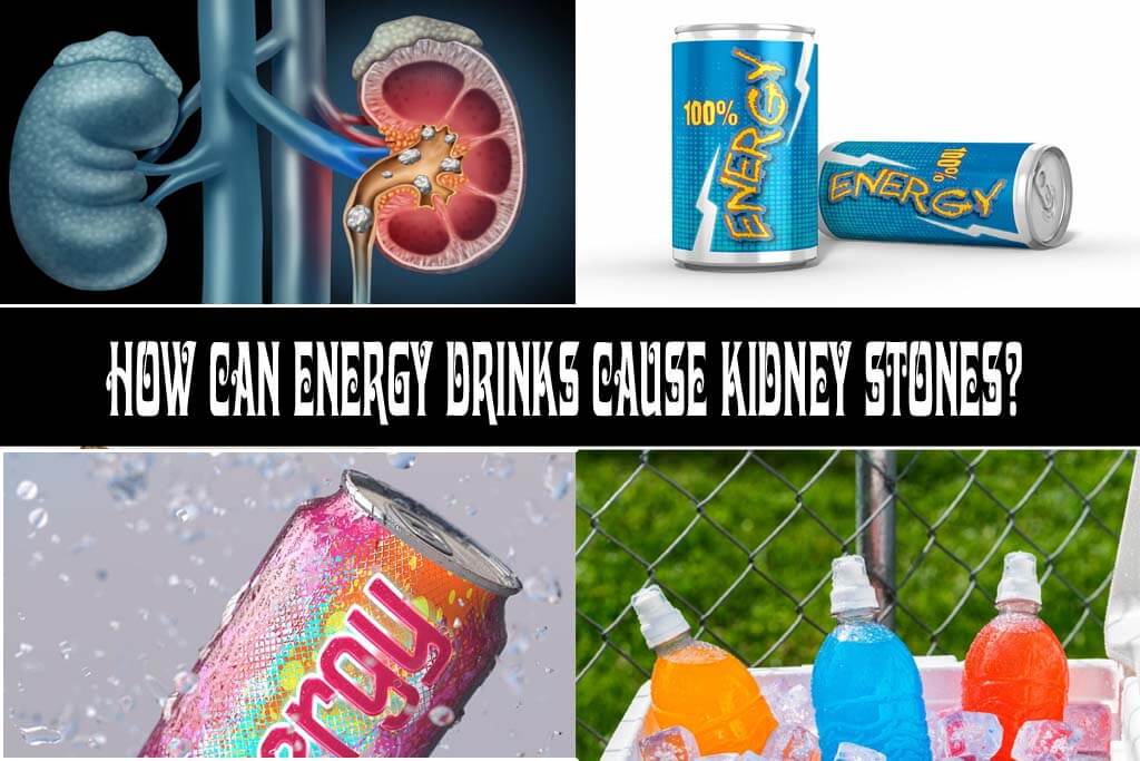 How Can Energy Drinks Cause Kidney Stones