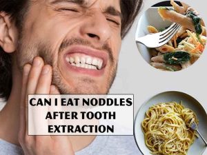CAN I EAT NODDLES AFTER TOOTH EXTRACTION