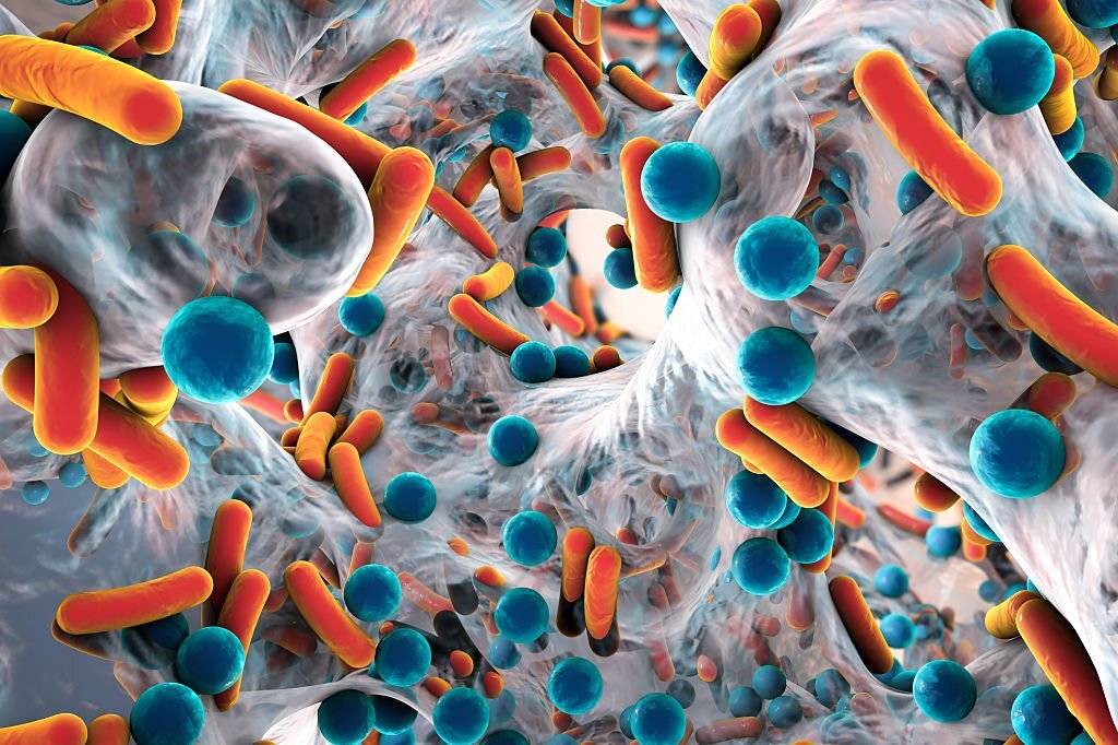 A.staphylococuss - How Food Handlers Can Identify Pathogens